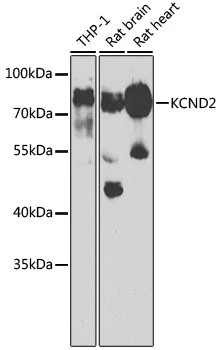 WB analysis of various sample lysates using GTX54373 Kv4.2 antibody. Dilution : 1:1000 Loading : 25microg per lane WB analysis of various sample lysates using GTX54373 Kv4.2 antibody. Dilution : 1:1000 Loading : 25microg per lane