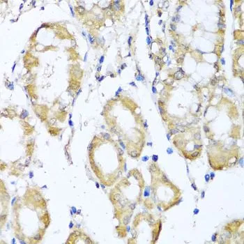 IHC-P analysis of human stomach tissue using GTX54373 Kv4.2 antibody. Dilution : 1:100