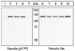 WB analysis of COS cells co-transfected with activated Src and His-tagged chicken vinculin cDNA which were either untreated (Lane 1 and 6) or treated with vanadate for 24 hr (Lane 2-5 and 7-10) using GTX54517 Vinculin (phospho Tyr100) antibody (left panel) or Vinculin antibody (right panel). WB analysis of COS cells co-transfected with activated Src and His-tagged chicken vinculin cDNA which were either untreated (Lane 1 and 6) or treated with vanadate for 24 hr (Lane 2-5 and 7-10) using GTX54517 Vinculin (phospho Tyr100) antibody (left panel) or Vinculin antibody (right panel).
