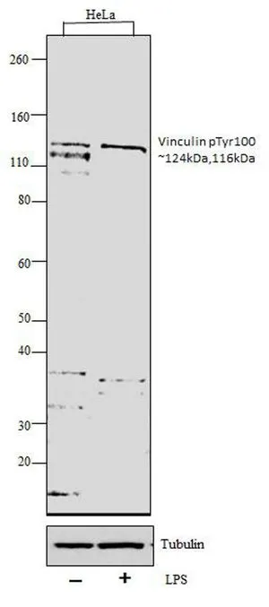 WB analysis of whole cell extracts (30 ug lysate) of HeLa (Lane 1) and HeLa treated with 100ng/ml of LPS for 20mins (Lane 2) using GTX54517 Vinculin (phospho Tyr100) antibody. Dilution : 1:1000