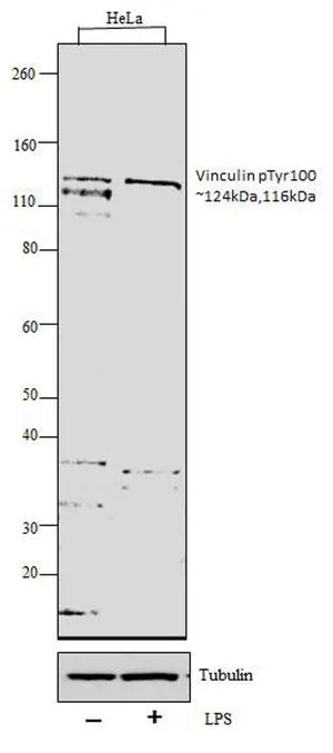 WB analysis of whole cell extracts (30 microg lysate) of HeLa (Lane 1) and HeLa treated with 100ng/ml of LPS for 20mins (Lane 2) using GTX54517 Vinculin (phospho Tyr100) antibody. Dilution : 1:1000