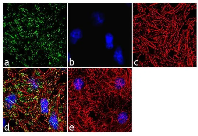 ICC/IF analysis of HeLa cells using GTX54517 Vinculin (phospho Tyr100) antibody. Panel e is a no primary antibody control. Green : Primary antibody Blue : Nuclei Red : Actin Fixation : 4% paraformaldehyde Permeabilization : 0.1% Triton X-100 for 10 minutes Dilution : 1:250 dilution in 0.1% BSA and incubated for 3 hours at room temperature