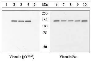 WB analysis of COS cells co-transfected with activated Src and His-tagged chicken vinculin cDNA which were either untreated (Lane 1 and 6) or treated with vanadate for 24hr (Lane 2-5 and 7-10) using GTX54518 Vinculin (phospho Tyr1065) antibody (left panel) or Vinculin antibody (right panel). WB analysis of COS cells co-transfected with activated Src and His-tagged chicken vinculin cDNA which were either untreated (Lane 1 and 6) or treated with vanadate for 24hr (Lane 2-5 and 7-10) using GTX54518 Vinculin (phospho Tyr1065) antibody (left panel) or Vinculin antibody (right panel).