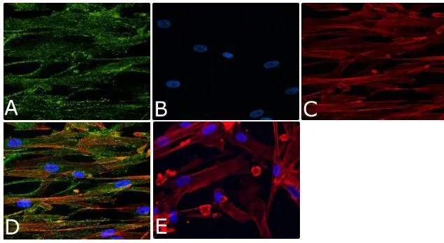 ICC/IF analysis of HUVEC cells using GTX54518 Vinculin (phospho Tyr1065) antibody. Panel e is a no primary antibody control. Green : Primary antibody Blue : Nuclei Red : Actin Fixation : 4% paraformaldehyde Permeabilization : 0.25% Triton X-100 for 10 minutes Dilution : 1:250 dilution in 1% BSA incubated for 3 hours at room temperature