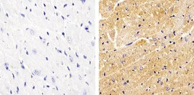 IHC-P analysis of mouse heart tissue using GTX54519 Vinculin (phospho Tyr822) antibody. Right : Primary antibody Left : Negative control without primary antibody Antigen retrieval : 10mM sodium citrate (pH 6.0), microwaved for 8-15 min Dilution : 1:20 IHC-P analysis of mouse heart tissue using GTX54519 Vinculin (phospho Tyr822) antibody. Right : Primary antibody Left : Negative control without primary antibody Antigen retrieval : 10mM sodium citrate (pH 6.0), microwaved for 8-15 min Dilution : 1:20