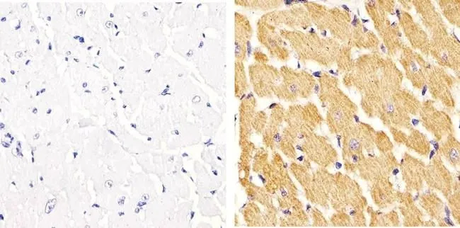 IHC-P analysis of rat heart tissue using GTX54519 Vinculin (phospho Tyr822) antibody. Right : Primary antibody Left : Negative control without primary antibody Antigen retrieval : 10mM sodium citrate (pH 6.0), microwaved for 8-15 min Dilution : 1:20