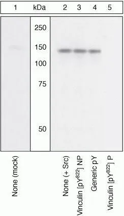 WB (peptide competition) analysis of CEFs left untransfected (Lane 1) or transfected with Src (Lane 2-5) using GTX54519 Vinculin (phospho Tyr822) antibody prior incubated with the non-phosphopeptide corresponding to the immunogen (Lane 3), a generic phosphotyrosine-containing peptide (Lane 4), or, the phosphopeptide immunogen (Lane 5). The data show that only the immunogen phosphopeptide blocks the signal, demonstrating the specificity of the antibody.