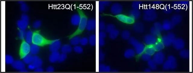 ICC/IF analysis of 293T cells transfected with an Htt23Q (left panel) and Htt148Q (right panel) stop constructs ending in amino acid 552 using GTX54521 Huntingtin (neoepitope 552) antibody. Fixation : Formalin Permeabilization : 0.1% Triton X-100 in TBS for 10 minutes Dilution : 1:50 for at least 1 hour at room temperature
