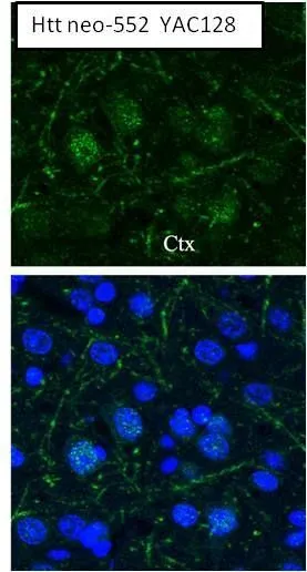 IHC-Fr analysis of mouse cortex tissue (from transgenic HD mice of the YAC128 line) using GTX54521 Huntingtin (neoepitope 552) antibody. Green : Primary antibody Blue : DAPI Dilution : 1:50