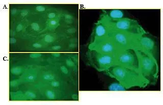 ICC/IF analysis of MDCK cells were left untreated (A),stimulated with H2O2 (1 mM for 10 minutes) (B),or pretreated with PP2 prior to H2O2 stimulation (C) using GTX54529 Src (phospho Tyr416) antibody (Alexa Fluor 488).