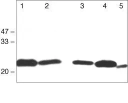 WB analysis of Rat liver(Lane 1),Rat kidney(Lane 2),MDCK cells(Lane 3),Caco-2 cells(Lane 4),Mouse hepatocytes(Lane 5) lysate using GTX54539 Claudin 1 antibody.