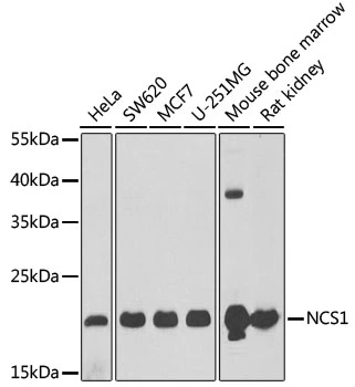 WB analysis of various sample lysates using GTX54541 NCS1 antibody. Dilution : 1:1000 Loading : 25microg per lane WB analysis of various sample lysates using GTX54541 NCS1 antibody. Dilution : 1:1000 Loading : 25microg per lane