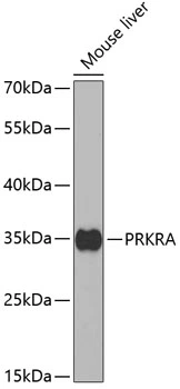WB analysis of mouse liver tissue lysate using GTX54546 PACT antibody. Dilution : 1:1000 Loading : 25microg per lane WB analysis of mouse liver tissue lysate using GTX54546 PACT antibody. Dilution : 1:1000 Loading : 25microg per lane
