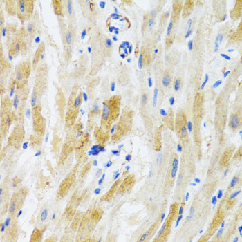 IHC-P analysis of mouse heart tissue using GTX54556 PHPT1 antibody. Dilution : 1:100