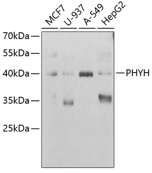 WB analysis of various sample lysates using GTX54557 PHYH antibody. The signal was developed with ECL plus-Enhanced. Dilution : 1:1000 Loading : 25microg per lane WB analysis of various sample lysates using GTX54557 PHYH antibody. The signal was developed with ECL plus-Enhanced. Dilution : 1:1000 Loading : 25microg per lane