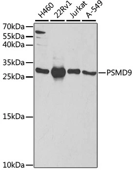 WB analysis of various sample lysates using GTX54558 PSMD9 antibody. The signal was developed with ECL plus-Enhanced. Dilution : 1:1000 Loading : 25microg per lane WB analysis of various sample lysates using GTX54558 PSMD9 antibody. The signal was developed with ECL plus-Enhanced. Dilution : 1:1000 Loading : 25microg per lane
