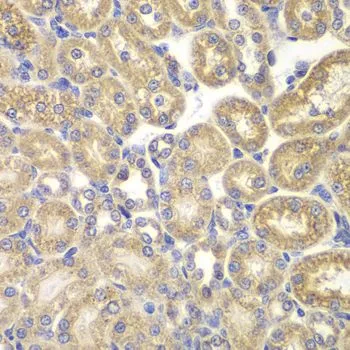 IHC-P analysis of rat kidney tissue using GTX54558 PSMD9 antibody. Dilution : 1:200