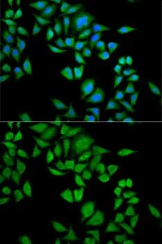ICC/IF analysis of U2OS cells using GTX54559 QDPR antibody. Blue : DAPI
