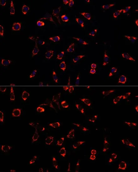 ICC/IF analysis of L929 cells using GTX54563 PAH antibody. Blue : DAPI Dilution : 1:100