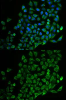 ICC/IF analysis of U2OS cells using GTX54566 Nudel antibody. Blue : DAPI