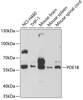 WB analysis of various sample lysates using GTX54568 PDE1B antibody. Dilution : 1:500 Loading : 25microg per lane WB analysis of various sample lysates using GTX54568 PDE1B antibody. Dilution : 1:500 Loading : 25microg per lane