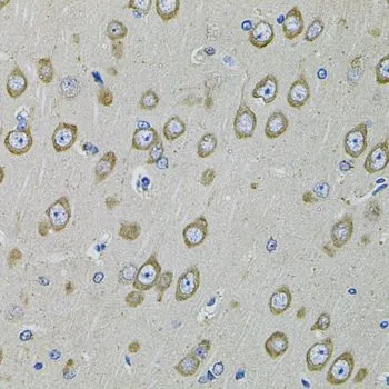 IHC-P analysis of rat brain tissue using GTX54568 PDE1B antibody. Dilution : 1:100