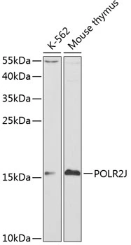WB analysis of various sample lysates using GTX54570 POLR2J antibody. Dilution : 1:1000 Loading : 25microg per lane WB analysis of various sample lysates using GTX54570 POLR2J antibody. Dilution : 1:1000 Loading : 25microg per lane