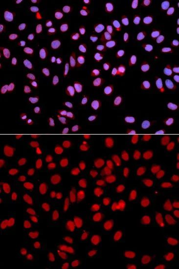ICC/IF analysis of U2OS cells using GTX54570 POLR2J antibody. Blue : DAPI