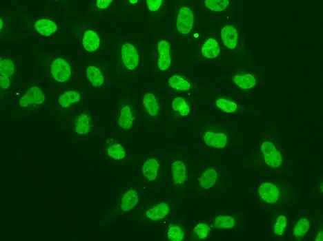 ICC/IF analysis of A549 cells using GTX54570 POLR2J antibody.