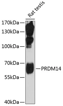 WB analysis of rat testis tissue lysate using GTX54571 PRDM14 antibody. The signal was developed with ECL plus-Enhanced. Dilution : 1:1000 Loading : 25microg per lane