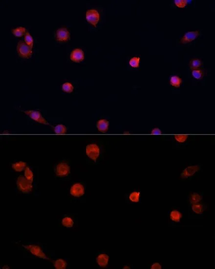 ICC/IF analysis of NIH/3T3 cells using GTX54571 PRDM14 antibody. Blue : DAPI Dilution : 1:100