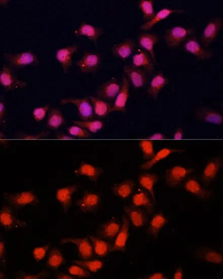 ICC/IF analysis of HeLa cells using GTX54571 PRDM14 antibody. Blue : DAPI Dilution : 1:100