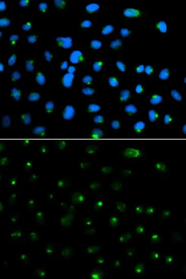 ICC/IF analysis of MCF7 cells using GTX54581 PSAP antibody. Blue : DAPI
