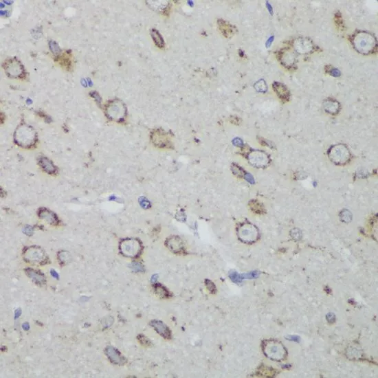 IHC-P analysis of rat brain tissue using GTX54581 PSAP antibody. Dilution : 1:200