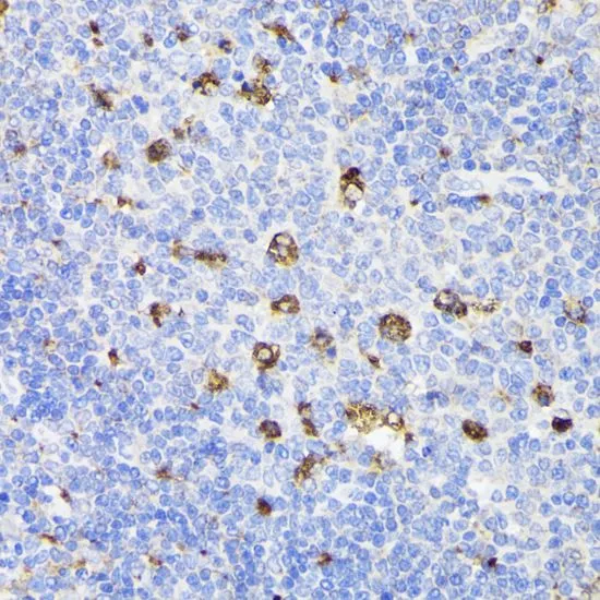 IHC-P analysis of rat spleen tissue using GTX54581 PSAP antibody. Dilution : 1:200