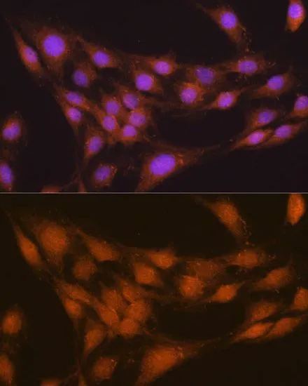 ICC/IF analysis of C6 cells using GTX54585 NRBF2 antibody. Blue : DAPI Dilution : 1:100