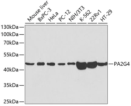 WB analysis of various sample lysates using GTX54589 EBP1 antibody. Dilution : 1:1000 Loading : 25microg per lane WB analysis of various sample lysates using GTX54589 EBP1 antibody. Dilution : 1:1000 Loading : 25microg per lane