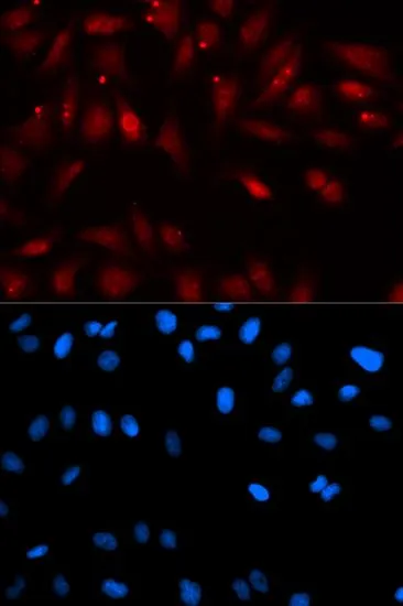 ICC/IF analysis of U2OS cells using GTX54589 EBP1 antibody. Blue : DAPI