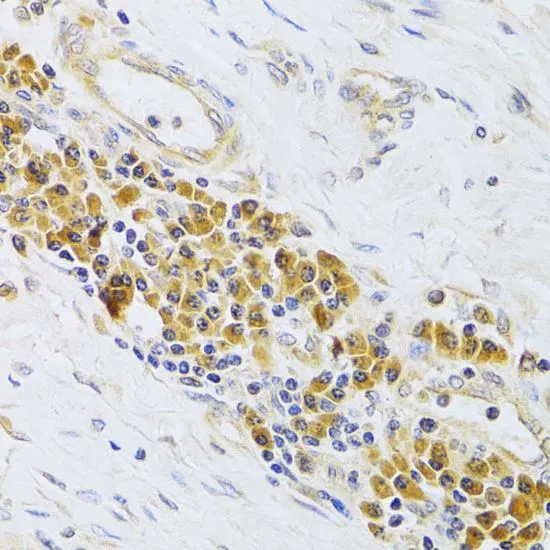 IHC-P analysis of human esophagus tissue using GTX54589 EBP1 antibody. Dilution : 1:100