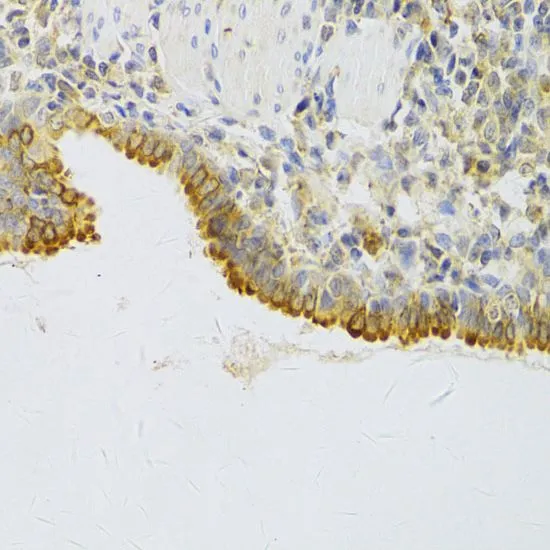 IHC-P analysis of rat lung tissue using GTX54589 EBP1 antibody. Dilution : 1:100