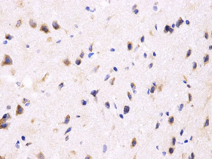 IHC-P analysis of rat brain tissue using GTX54592 PPP2R4 antibody. Dilution : 1:200