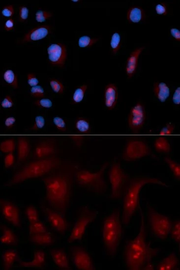 ICC/IF analysis of U2OS cells using GTX54594 PLCB1 antibody. Blue : DAPI