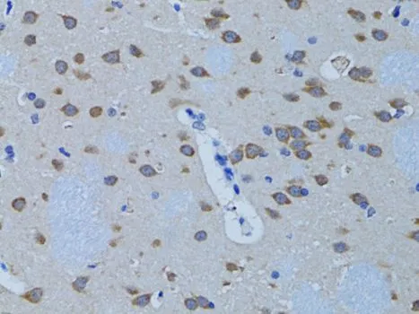 IHC-P analysis of rat brain tissue using GTX54594 PLCB1 antibody. Dilution : 1:100