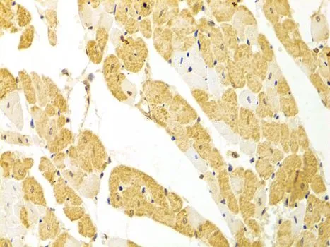 IHC-P analysis of rat heart tissue using GTX54594 PLCB1 antibody. Dilution : 1:100