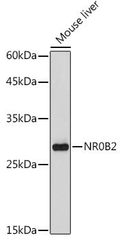 WB analysis of mouse liver tissue lysate using GTX54598 NR0B2 antibody. Dilution : 1:1000 Loading : 25microg per lane WB analysis of mouse liver tissue lysate using GTX54598 NR0B2 antibody. Dilution : 1:1000 Loading : 25microg per lane