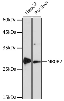 WB analysis of various sample lysates using GTX54598 NR0B2 antibody. Dilution : 1:1000 Loading : 25microg per lane