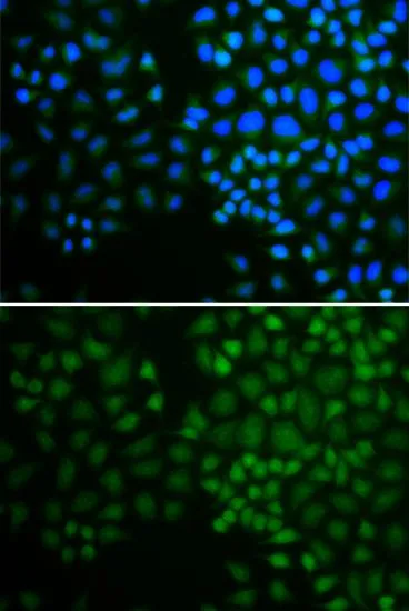 ICC/IF analysis of U2OS cells using GTX54598 NR0B2 antibody. Blue : DAPI