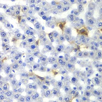 IHC-P analysis of rat liver tissue using GTX54598 NR0B2 antibody. Dilution : 1:100