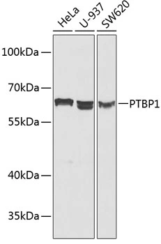 WB analysis of various sample lysates using GTX54619 PTBP1 antibody. Dilution : 1:1000 Loading : 25microg per lane WB analysis of various sample lysates using GTX54619 PTBP1 antibody. Dilution : 1:1000 Loading : 25microg per lane