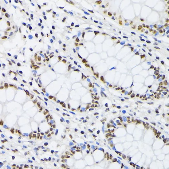 IHC-P analysis of human colon tissue using GTX54619 PTBP1 antibody. Dilution : 1:100